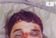 The bloodied and bruised face of Baha Mousa after his death in British military custody in Iraq