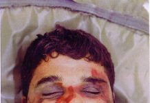 A very badly beaten Baha Mousa, an Iraqi hotel worker, tortured by British soldiers in Iraq