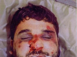 The battered body of Baha Mousa after he was seized by British forces in southern Iraq in September 2003