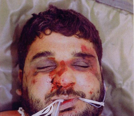 The battered body of Baha Mousa after he was seized by British forces in southern Iraq in September 2003