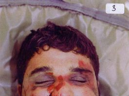 Doctor at centre of Baha Mousa’s death faces a six-week ‘fitness to practice’ hearing Badly beaten face of Baha Mousa after his death at the hands of British troops on 15 September 2003