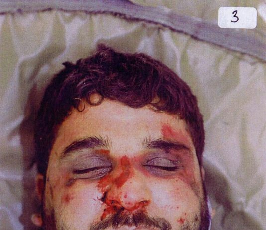 Badly beaten face of Baha Mousa after his death at the hands of British troops on 15 September 2003