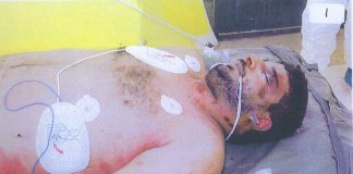 The body of Baha Mousa showing some of the 93 injuries that doctor Keilloh ‘did not notice’ after being beaten by British troops