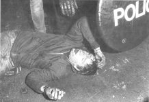Thatcher’s law at work – miner lies badly injured at Maltby in September 1984. He had been battered by police forces sent up from London to attack miners picket lines