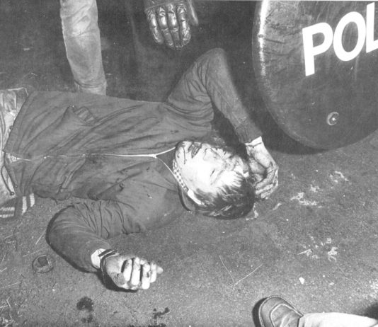 Thatcher’s law at work – miner lies badly injured at Maltby in September 1984. He had been battered by police forces sent up from London to attack miners picket lines