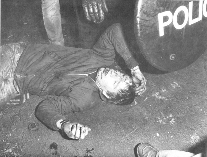 Thatcher’s law at work – miner lies badly injured at Maltby in September 1984. He had been battered by police forces sent up from London to attack miners picket lines