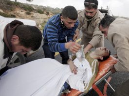 Young Palestinian injured after an attack by Israeli forces is treated for his injuries