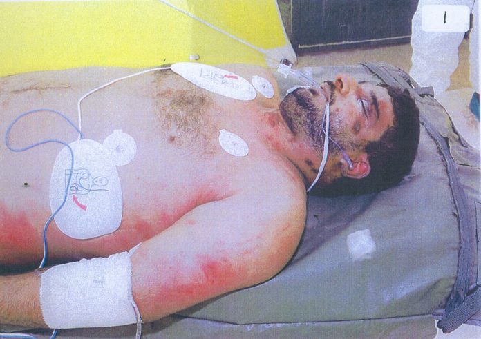 The body of Iraqi hotel worker, Baha Mousa after being beaten to death by British troops in Basra in September 2003