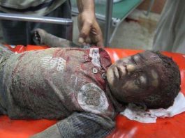 Hundreds of Palestinian children have been charred or badly burned by Israeli missile strikes