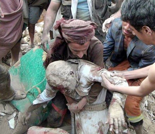 An elderly victim of a recent Saudi bombing raid on Yemen