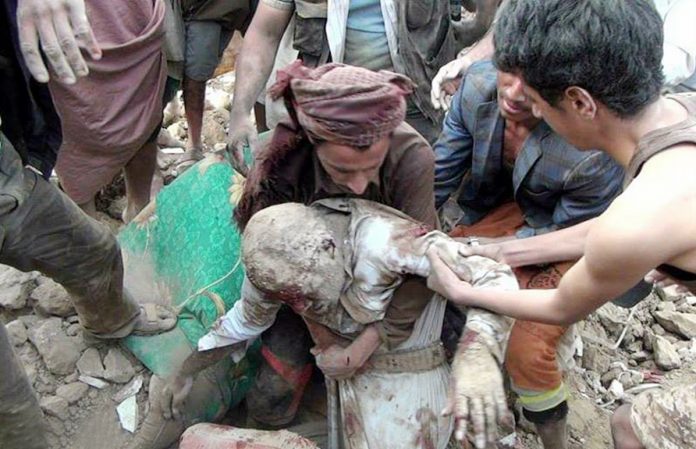 An elderly victim of a recent Saudi bombing raid on Yemen