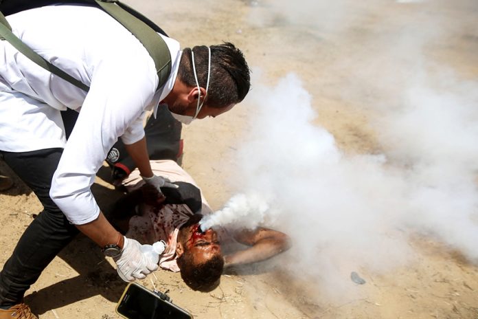 Palestinian shot in the face with a tear gas canister – Israel is accused of war crimes against Palestinians
