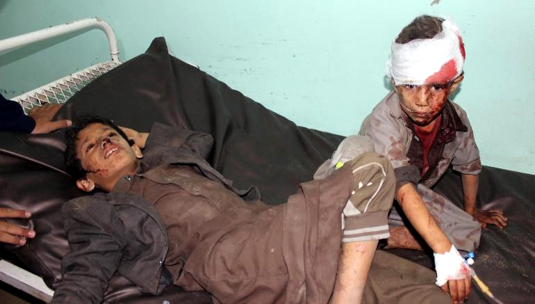 Child victims of the bombing campaign by the Saudi regime against the Yemeni people. Besides the immediate damage, Amnesty International reports that disabled people are extra hard-hit by lack of services and displacement